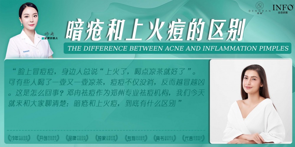 郑州专业祛痘机构在线解答：暗疮和上火痘的区别