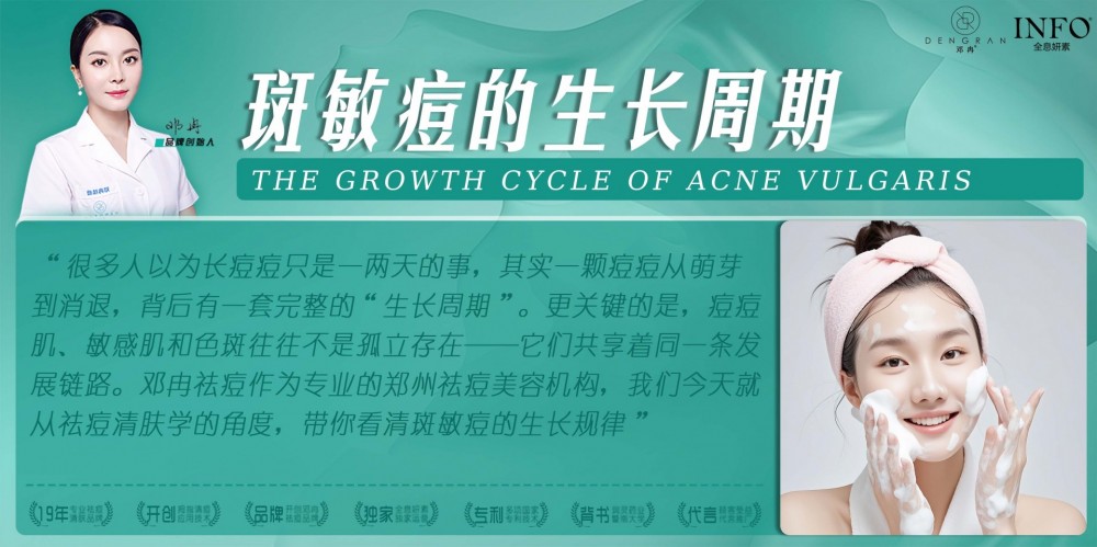 郑州祛痘美容机构在线解答:斑敏痘的生长周期